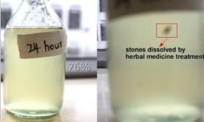 urine change in kidney