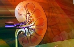 High Creatinine in Diabetic Nephropathy