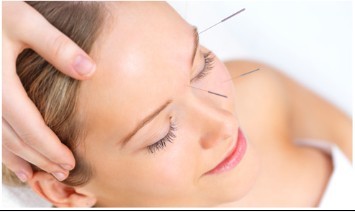 acupuncture