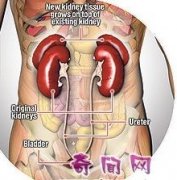 Potential Symptoms of Renal Duplication