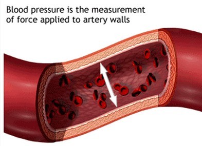 high blood pressure, proteinuria