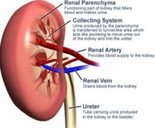 How to Treat Bilateral Renal Parenchyma Disease
