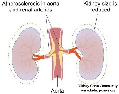 causes and treatment for kidney shrinkage