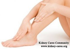 How to Treat Edema in IgA Nephropathy Naturally