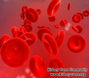 What Does Blood ++ in Urine Mean for Kidney Disease