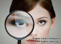Puffy Eyelids in IgA Nephropathy: Causes and Treatment
