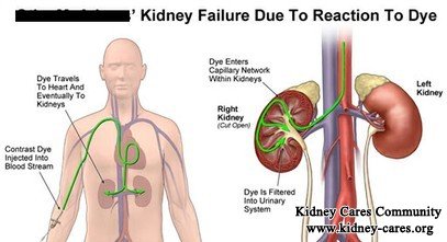 Can Contrast Dyes Cause Damages To Kidney Functions