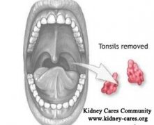 Tonsillectomy for IgA Nephropathy Treatment: Is It a Must