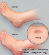How to Relieve Swelling in Ankles for Kidney Disease Patients