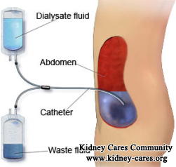 How to Prepare for Peritoneal Dialysis Catheter Surgery