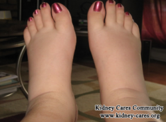 Will Purpura Cause Feet Swelling