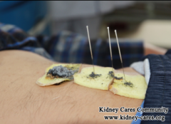 Health Benefits of Acupuncture In Treating Kidney Disease