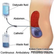 Hernias and Peritoneal Dialysis