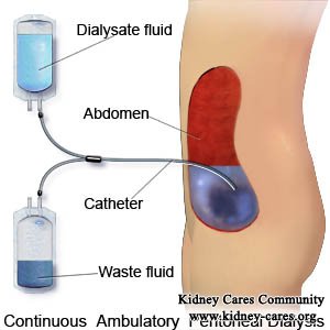 Peritoneal Dialysis