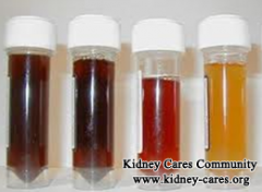What Does Blood in Urine after Dialysis Mean