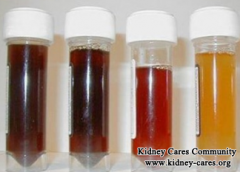 Repeated Hematuria in IgA Nephropathy