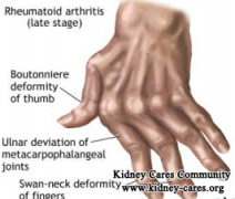 Chronic Kidney Disease and Arthritis