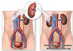 Is Kidney Transplantation A Complete Cure For Renal Failure