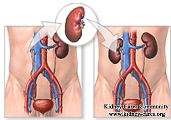 Is Kidney Transplantation A Complete Cure For Renal Failure 