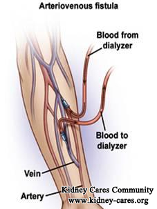 How To Prepare Dialysis