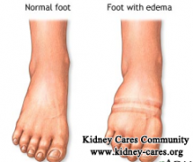 Edema in Stage 3 CKD: Causes and Treatment