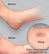 What Is The Pathogenesis Of Renal Edema
