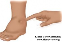 Can Edema Be Related To Chronic Kidney Disease