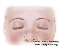 How to Prevent Chronic Kidney Disease (CKD) in Lupus