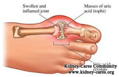 Gout And Polycystic Kidney Disease (PKD)