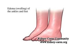 Swollen Ankles And Protein in Urine in IgA Nephropathy