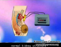 5cm Cyst In Kidney: How To Shrink It