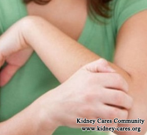 Will Elevated Creatinine Level In CKD Make You Very Itchy