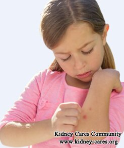 What Can Help with Extreme Itch When Dialysis Leaves High Levels of Phosphorus in Body