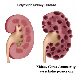Will All the PKD Patients End Up with Dialysis