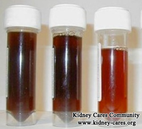 How to Reduce Blood In Urine with IgA Nephropathy