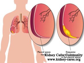 What Should I Do with Focal Segmental Glomerulosclerosis and Pleural Effusion