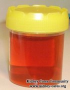How to Deal with Bloody Urine and Chronic Kidney Disease Stage 3