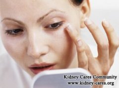 How to Deal with Puffy Eyes Caused by Diabetes