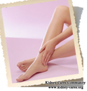 Will Years of Diabetes Cause Swelling in Lower Limbs