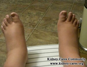 How to Eliminate Fluids in One Who Has CKD Stage 4