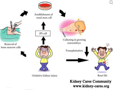 Can Kidney Failure be Cured by Stem Cell