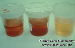 Why IgA Nephropathy Patients Have Blood in Urine