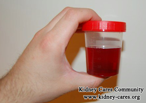 Is It Serious if You Have Stage 4 Kidney Disease and 3+ Blood in Urine