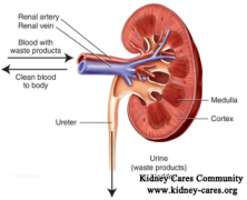 How to Strengthen Kidney with CKD Stage 4