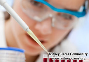 Will Creatinine Be Higher After Removing One Kidney