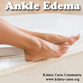 Why Does Edema Occur In Diabetic Nephropathy Patients