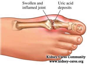 How Does CKD Patients Handle Uric Acid in the Blood