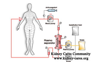 Blood Plasma Exchange Therapy For Diabetic Nephropathy