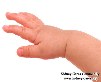 What Is The Good Medicine For Swelling In Kidney Failure