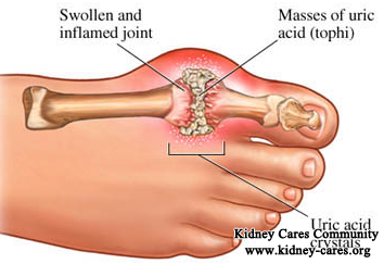 What Is The Treatment For Uric Acid Nephropathy